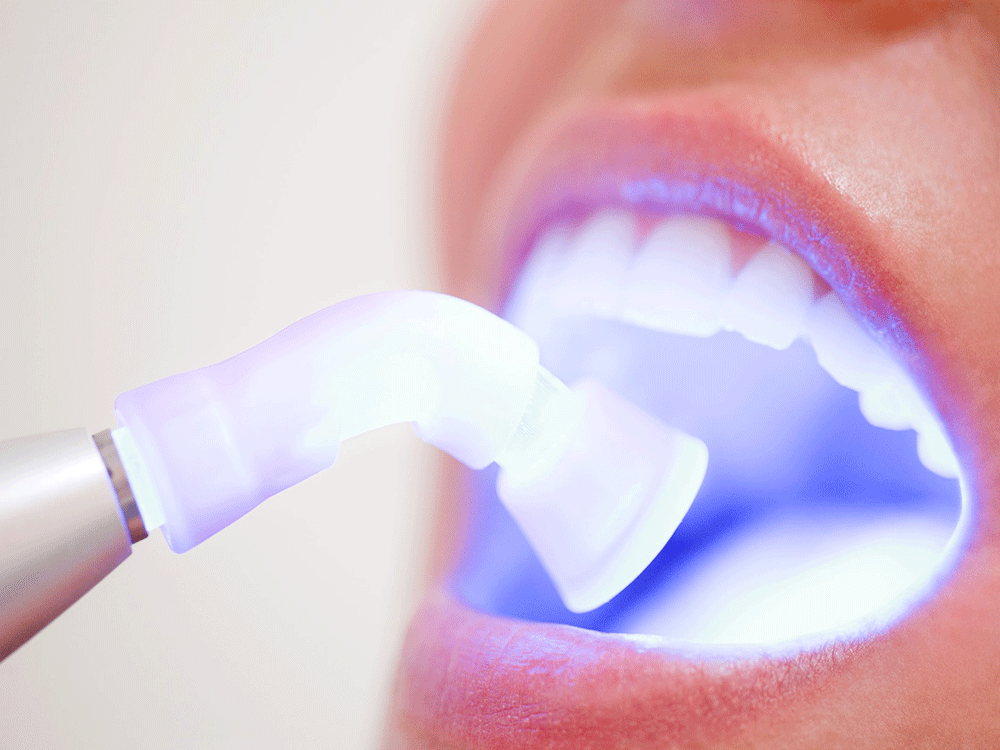 Soft tissue laser being used on a patient