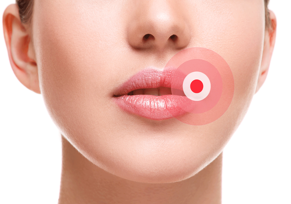 Close-up of a person's lower face with lips slightly parted and a red target-like graphic overlay on the right side of the lips.