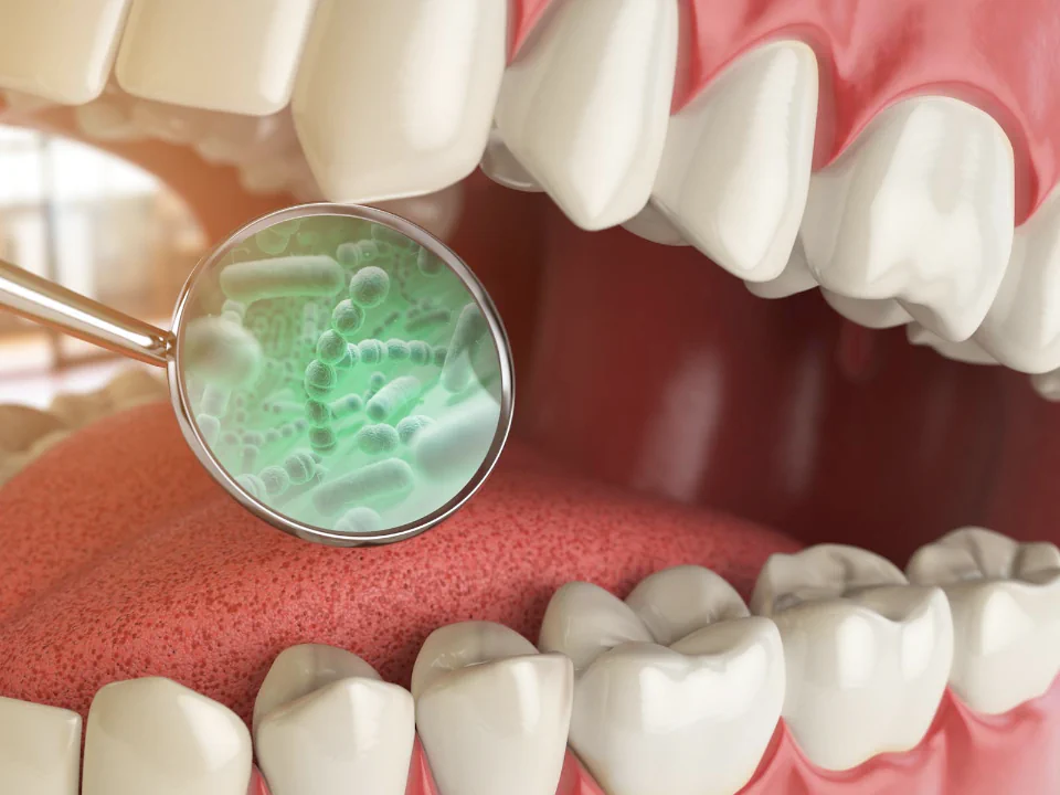 Bad breath treatment and halitosis treatment available at Drew Family Dentistry in Bend, OR