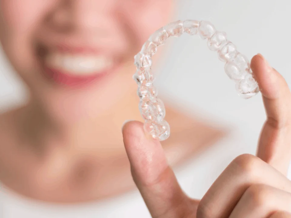 Retainers and retainer services available at Drew Family Dentistry in Bend, OR