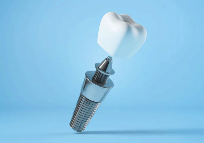 Dental implants available at Drew Family Dentistry in Bend, OR